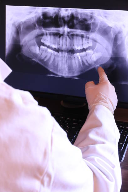 Best Emergency Gum Treatment in Wooster, OH