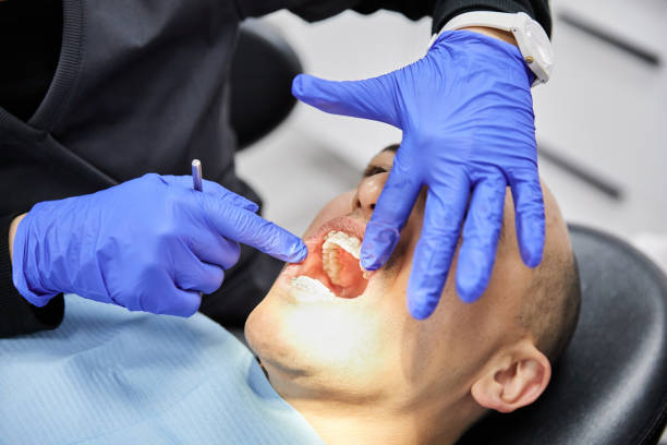 Best Emergency Denture Repair in Wooster, OH